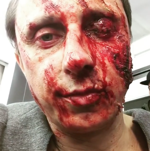 Вадим Галыгин поверг в шок фанатов снимком с обезображенным лицом