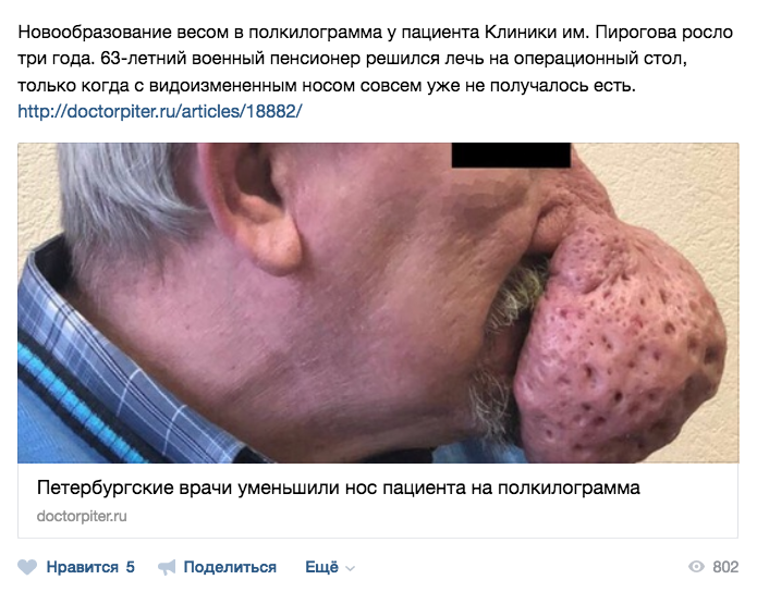 Петербургские врачи уменьшили нос пациента на полкилограмма. Фото https://vk.com/doctorpiter