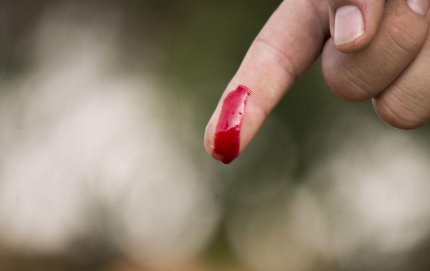 Новая разработка учёных печатает слои "био-чернил" прямо на пациенте, в буквальном смысле заклеивая рану полосками клееподобного вещества, из которого впоследствии вырастет настоящая новая кожа. Фото Pixabay
