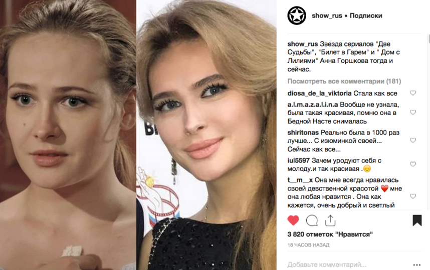 Актриса Анны Горшкова: была ли пластика – фото до и после