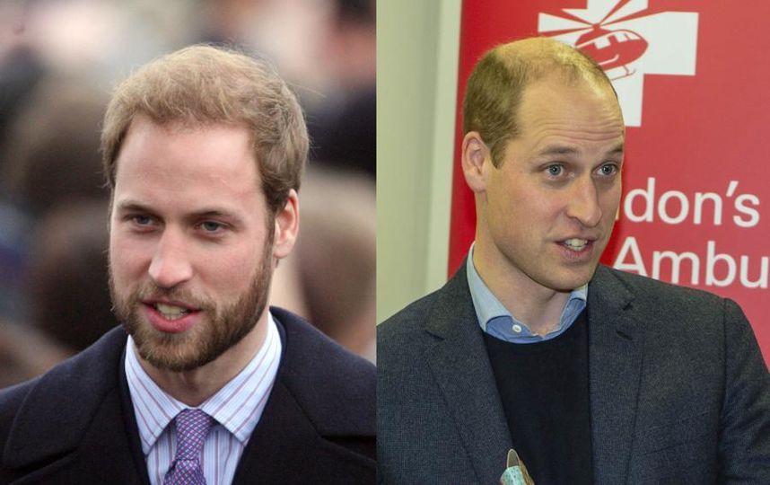 10YearsChallenge. Принц Уильям в конце 2008 года отрастил бороду. А вот спустя 10 лет волос на голове у него стало гораздо меньше. Фото Getty