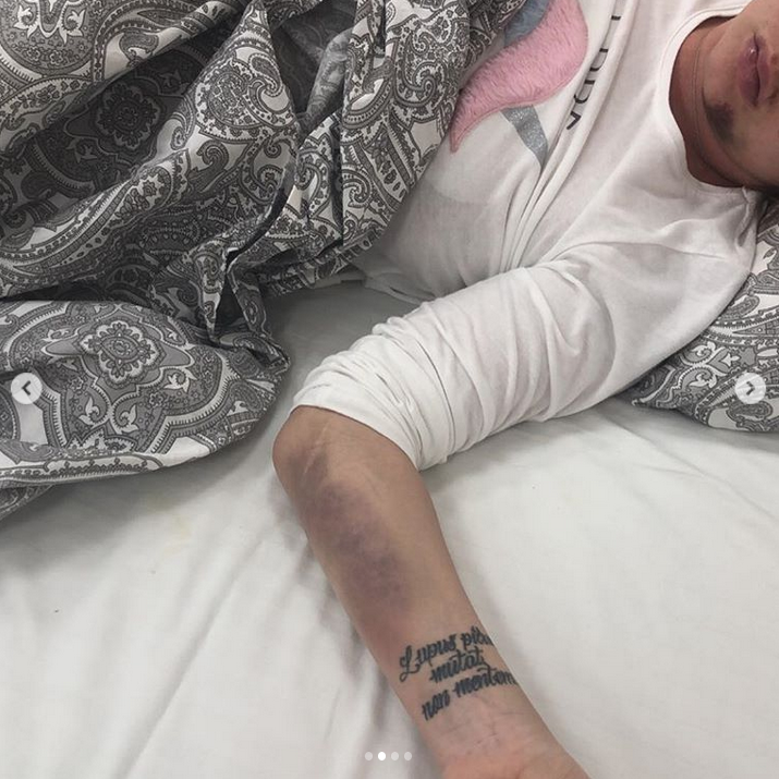 Певица МакSим после аварии. Фото Скриншот Instagram: @sokllovamargarita