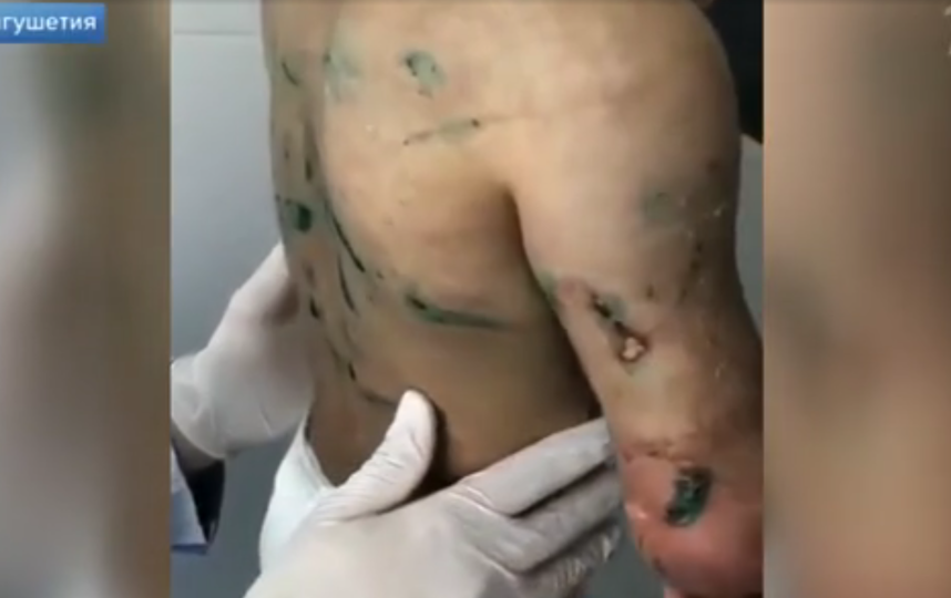 Кадры видеосюжета об Аише. Фото www.vesti.ru