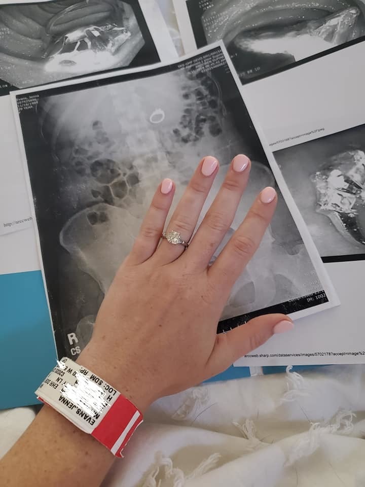 Американка проглотила обручальное кольцо во сне. Фото https://www.facebook.com/jenna.evans.121/