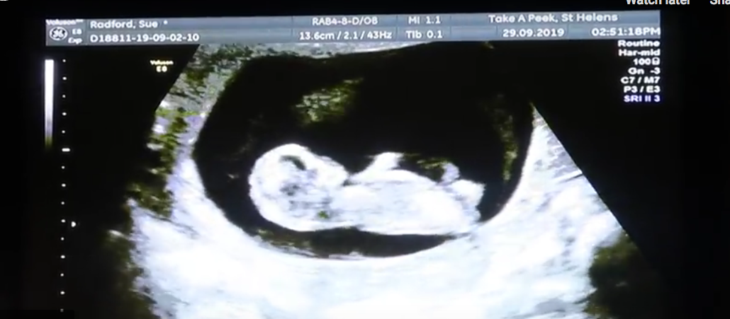 Обещавшая не рожать женщина забеременела в 22-й раз. Фото все- скриншот www.youtube.com/watch?v=8RcOi5bQ1vk