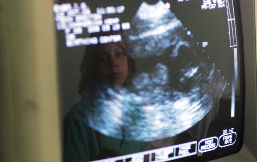 Перед абортом женщина будет обязана послушать сердцебиение плода, если это будет возможно. Фото Getty