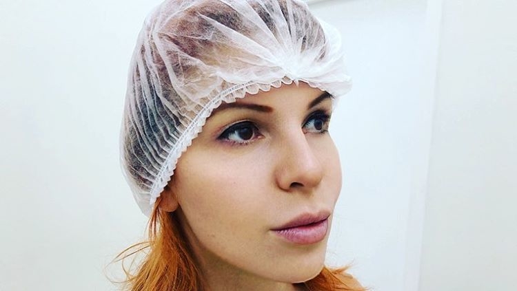 Наталья Штурм показала результат после процедуры. Фото instagram.com/nataliashturm