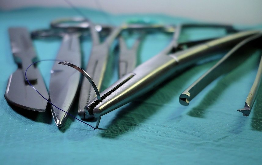 Операция по трансплантации продолжалась восемь часов. Фото Pixabay