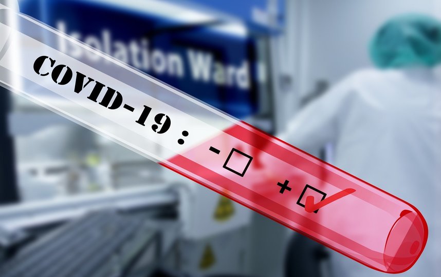 России передала тест-системы на коронавирус более 30 странам мира. Фото Pixabay