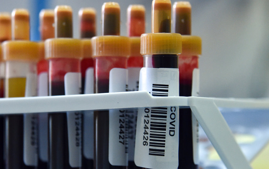 Тест на антитела к Covid-19 можно сдать бесплатно. Фото AFP