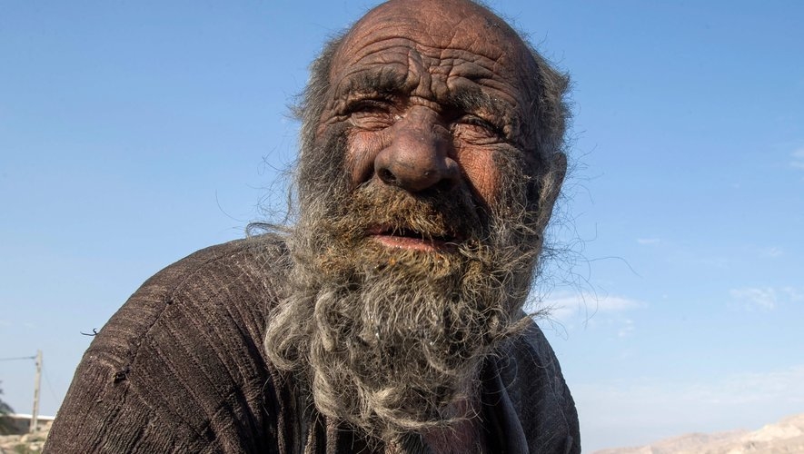Не мылся 63 года: cамый грязный человек в мире умер, так и не побывав в душе. Фото соцсети