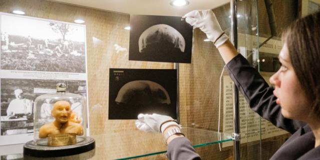 Маргарита Стрельчинина держит рентгеновский снимок черепа одного из погибших бойцов, который получил огнестрельное ранение лобной кости.