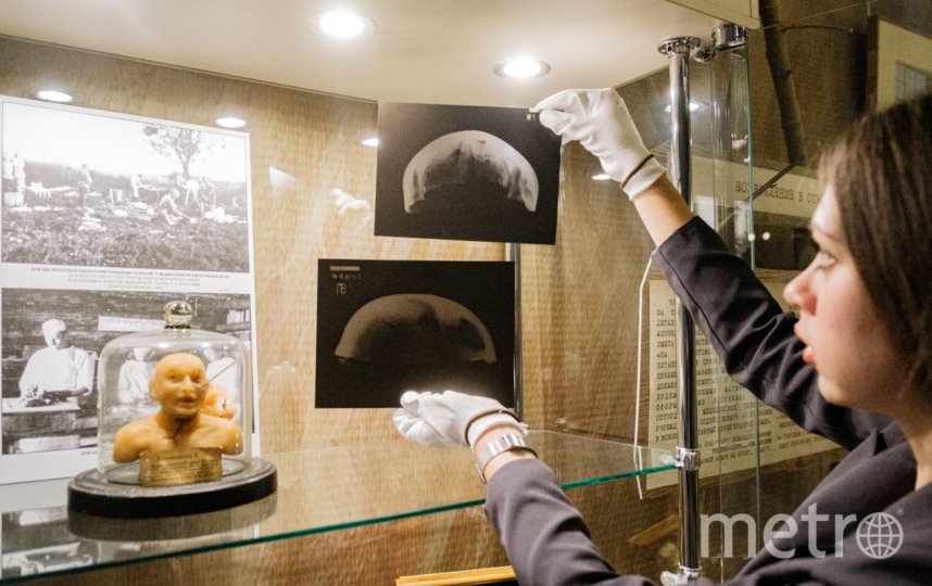 Маргарита Стрельчинина держит рентгеновский снимок черепа одного из погибших бойцов, который получил огнестрельное ранение лобной кости. Фото Алена Бобрович, "Metro"