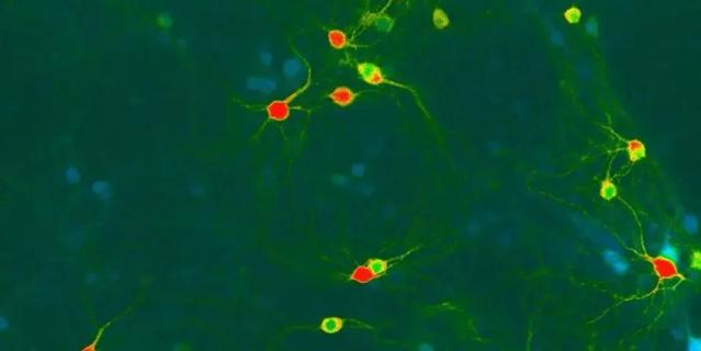 Это тела нервных клеток головного мозга. Цвет показывает наличие перекиси водорода в клетках: в каких её мало, а в каких, наоборот, много (от голубого к красному). Клетки с окислительным стрессом – жёлтые и красные. предоставлено Олегом Подгорным.
