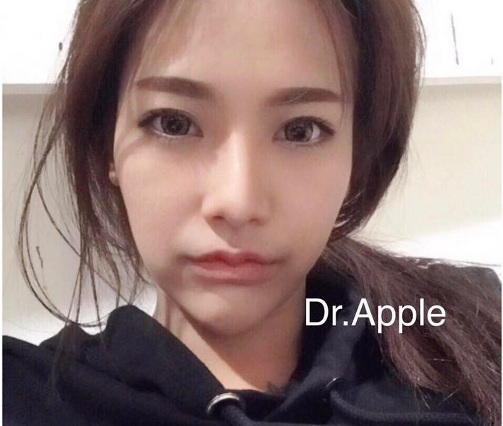 Фото: instagram.com/dr.apple_surgery/. 